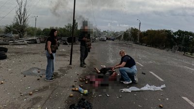 «Підбігла й побачила, що у нього немає ноги». Журналістка Суспільне Дніпро допомогла пораненому після удару РФ