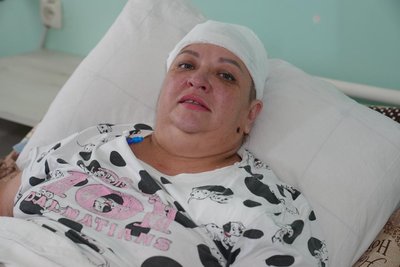 «Дрон вдарив по голові». На Дніпропетровщині лікують жінку, яку було поранено через атаку РФ на Нікополь